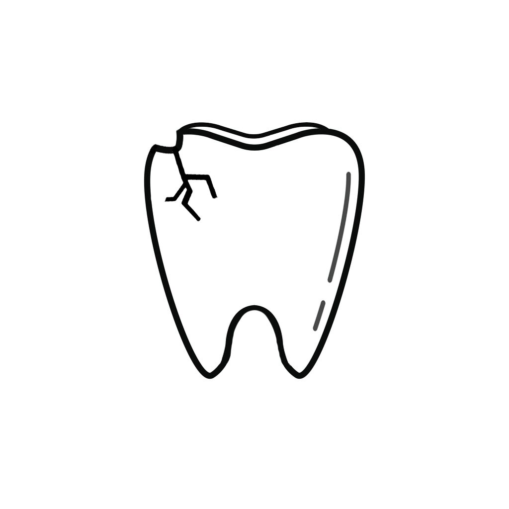 Centreville VA Dentist | I Chipped a Tooth! What Can I Do?